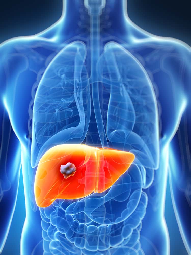 Liver damage as a result of Valsartan